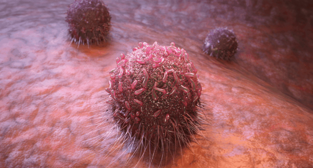 Spine Infections and Tumors Treatment