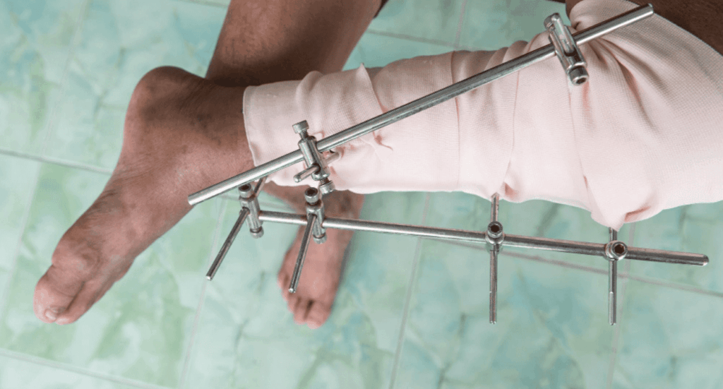 Best Deformity Correction Doctors In Pune