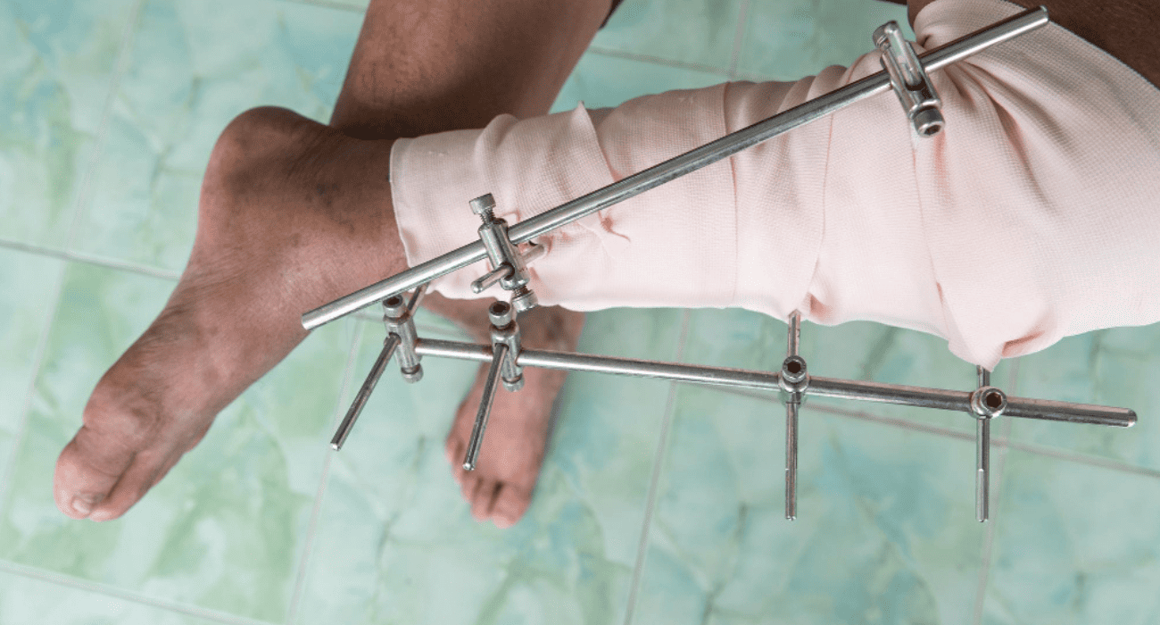 Best Deformity Correction Doctors In Pune