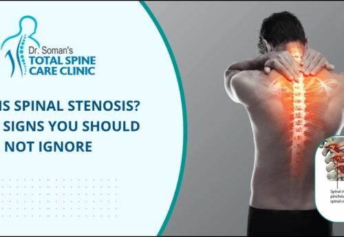 Spinal Stenosis - Early Signs