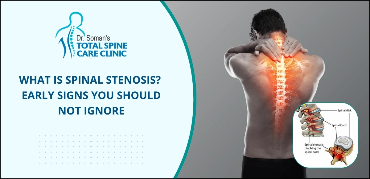 Spinal Stenosis - Early Signs